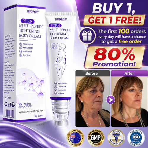 Hudros® PDRN Multi-Peptide Massaging Body Roller Cream- Anti-aging, Hydrating, Skin Firming & Lifting, Skin Repair, Even Tone, Acne and Dark Spot Treatment, Wart and Mole Removal, and Psoriasis Relief.