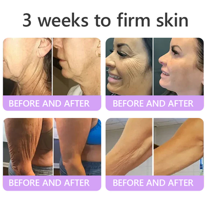 Hudros® PDRN Multi-Peptide Massaging Body Roller Cream- Anti-aging, Hydrating, Skin Firming & Lifting, Skin Repair, Even Tone, Acne and Dark Spot Treatment, Wart and Mole Removal, and Psoriasis Relief.