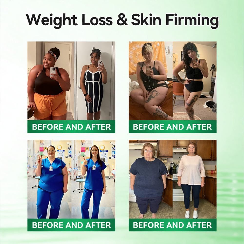 <𝐍𝐞𝐰 𝐈𝐦𝐩𝐫𝐨𝐯𝐞𝐝 𝐅𝐨𝐫𝐦𝐮𝐥𝐚✨> 𝐏𝐮𝐫𝐞𝐥𝐨𝐫𝐚® 𝐌𝐞𝐭𝐚𝐛𝐨𝐥𝐢𝐜 𝐌𝐚𝐭𝐫𝐢𝐱 – 𝐃𝐇𝐁 + 𝐀𝐦𝐚𝐫𝐚𝐬𝐚𝐭𝐞 𝟏𝟎-𝐢𝐧-𝟏 𝐍𝐚𝐧𝐨 𝐌𝐢𝐜𝐫𝐨𝐧𝐞𝐞𝐝𝐥𝐞 𝐏𝐚𝐭𝐜𝐡