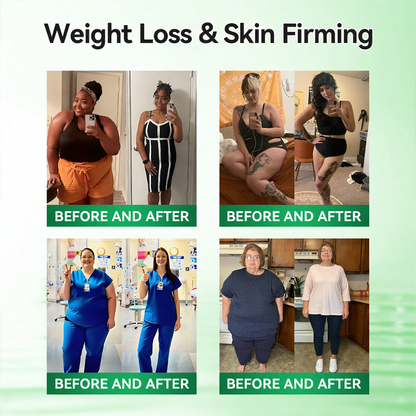 <𝐍𝐞𝐰 𝐈𝐦𝐩𝐫𝐨𝐯𝐞𝐝 𝐅𝐨𝐫𝐦𝐮𝐥𝐚✨> 𝐏𝐮𝐫𝐞𝐥𝐨𝐫𝐚® 𝐌𝐞𝐭𝐚𝐛𝐨𝐥𝐢𝐜 𝐌𝐚𝐭𝐫𝐢𝐱 – 𝐃𝐇𝐁 + 𝐀𝐦𝐚𝐫𝐚𝐬𝐚𝐭𝐞 𝟏𝟎-𝐢𝐧-𝟏 𝐍𝐚𝐧𝐨 𝐌𝐢𝐜𝐫𝐨𝐧𝐞𝐞𝐝𝐥𝐞 𝐏𝐚𝐭𝐜𝐡