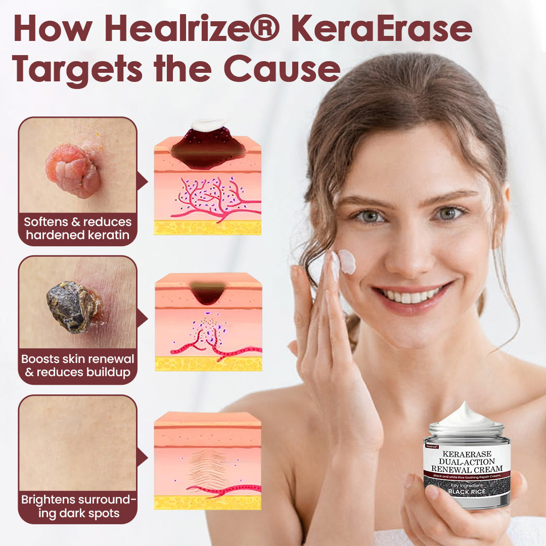 🇦🇺👨‍⚕️Australian Dermatology Recommendations:: Healrize® KeraErase Dual-Action Renewal Cream