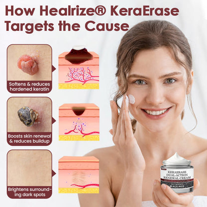 🇦🇺👨‍⚕️Australian Dermatology Recommendations:: Healrize® KeraErase Dual-Action Renewal Cream