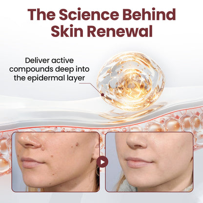 🇦🇺👨‍⚕️Australian Dermatology Recommendations:: Healrize® KeraErase Dual-Action Renewal Cream
