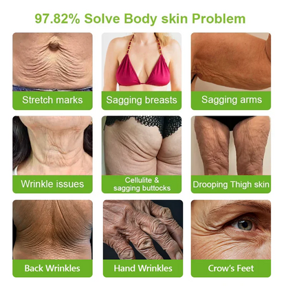 𝑯𝒆𝒂𝒍𝒓𝒊𝒛𝒆® 🧬𝑷𝑫𝑹𝑵 𝑨𝒏𝒕𝒊-𝑨𝒈𝒊𝒏𝒈 & 𝑻𝒂𝒓𝒈𝒆𝒕𝒆𝒅 𝑺𝒑𝒐𝒕 𝑹𝒆𝒏𝒆𝒘𝒂𝒍 𝑺𝒕𝒊𝒄𝒌（𝑯𝒆𝒍𝒑𝒔 𝑺𝒎𝒐𝒐𝒕𝒉 𝑾𝒓𝒊𝒏𝒌𝒍𝒆𝒔, 𝑺𝒖𝒑𝒑𝒐𝒓𝒕 𝑭𝒊𝒓𝒎𝒆𝒓-𝑳𝒐𝒐𝒌𝒊𝒏𝒈 𝑺𝒌𝒊𝒏, 𝒂𝒏𝒅 𝑰𝒎𝒑𝒓𝒐𝒗𝒆 𝑻𝒉𝒆 𝑨𝒑𝒑𝒆𝒂𝒓𝒂𝒏𝒄𝒆 𝑶𝒇 𝑽𝒊𝒔𝒊𝒃𝒍𝒆 𝑺𝒑𝒐𝒕𝒔）