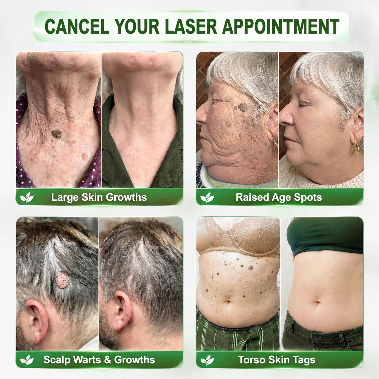 𝑯𝒆𝒂𝒍𝒓𝒊𝒛𝒆® 🧬𝑷𝑫𝑹𝑵 𝑨𝒏𝒕𝒊-𝑨𝒈𝒊𝒏𝒈 & 𝑻𝒂𝒓𝒈𝒆𝒕𝒆𝒅 𝑺𝒑𝒐𝒕 𝑹𝒆𝒏𝒆𝒘𝒂𝒍 𝑺𝒕𝒊𝒄𝒌（𝑯𝒆𝒍𝒑𝒔 𝑺𝒎𝒐𝒐𝒕𝒉 𝑾𝒓𝒊𝒏𝒌𝒍𝒆𝒔, 𝑺𝒖𝒑𝒑𝒐𝒓𝒕 𝑭𝒊𝒓𝒎𝒆𝒓-𝑳𝒐𝒐𝒌𝒊𝒏𝒈 𝑺𝒌𝒊𝒏, 𝒂𝒏𝒅 𝑰𝒎𝒑𝒓𝒐𝒗𝒆 𝑻𝒉𝒆 𝑨𝒑𝒑𝒆𝒂𝒓𝒂𝒏𝒄𝒆 𝑶𝒇 𝑽𝒊𝒔𝒊𝒃𝒍𝒆 𝑺𝒑𝒐𝒕𝒔）