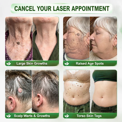 𝑯𝒆𝒂𝒍𝒓𝒊𝒛𝒆® 🧬𝑷𝑫𝑹𝑵 𝑨𝒏𝒕𝒊-𝑨𝒈𝒊𝒏𝒈 & 𝑻𝒂𝒓𝒈𝒆𝒕𝒆𝒅 𝑺𝒑𝒐𝒕 𝑹𝒆𝒏𝒆𝒘𝒂𝒍 𝑺𝒕𝒊𝒄𝒌（𝑯𝒆𝒍𝒑𝒔 𝑺𝒎𝒐𝒐𝒕𝒉 𝑾𝒓𝒊𝒏𝒌𝒍𝒆𝒔, 𝑺𝒖𝒑𝒑𝒐𝒓𝒕 𝑭𝒊𝒓𝒎𝒆𝒓-𝑳𝒐𝒐𝒌𝒊𝒏𝒈 𝑺𝒌𝒊𝒏, 𝒂𝒏𝒅 𝑰𝒎𝒑𝒓𝒐𝒗𝒆 𝑻𝒉𝒆 𝑨𝒑𝒑𝒆𝒂𝒓𝒂𝒏𝒄𝒆 𝑶𝒇 𝑽𝒊𝒔𝒊𝒃𝒍𝒆 𝑺𝒑𝒐𝒕𝒔）